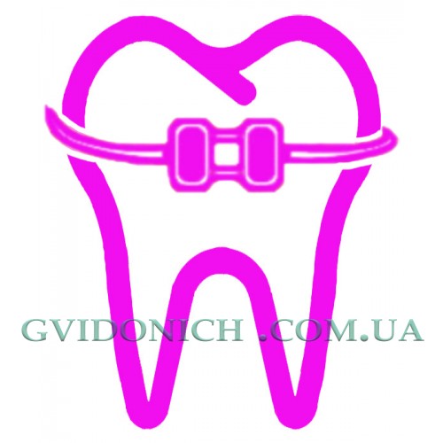 Как чистить зубы в период ношения брекетов