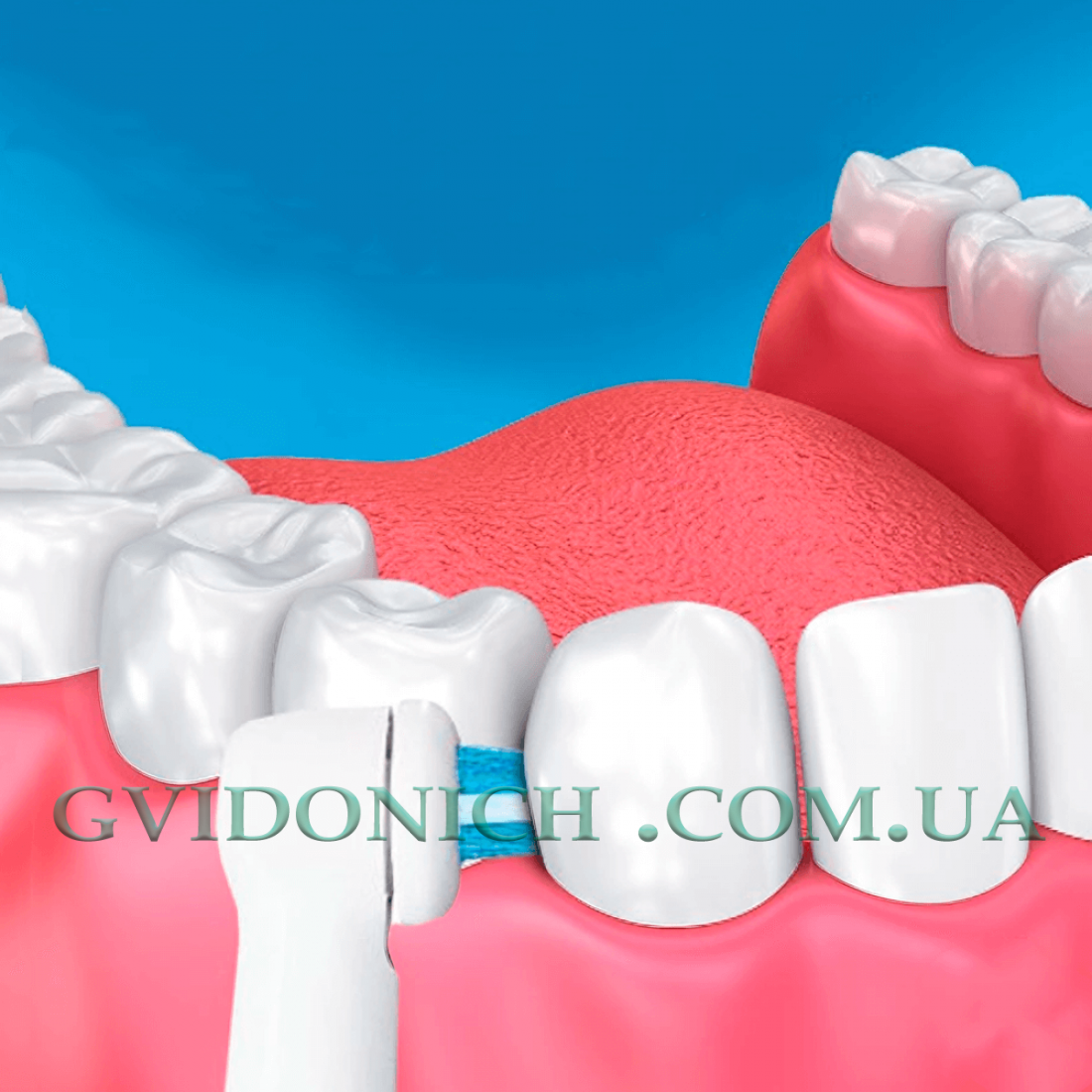 Насадки для Oral b Power Tip по догляду за брекет-системой 