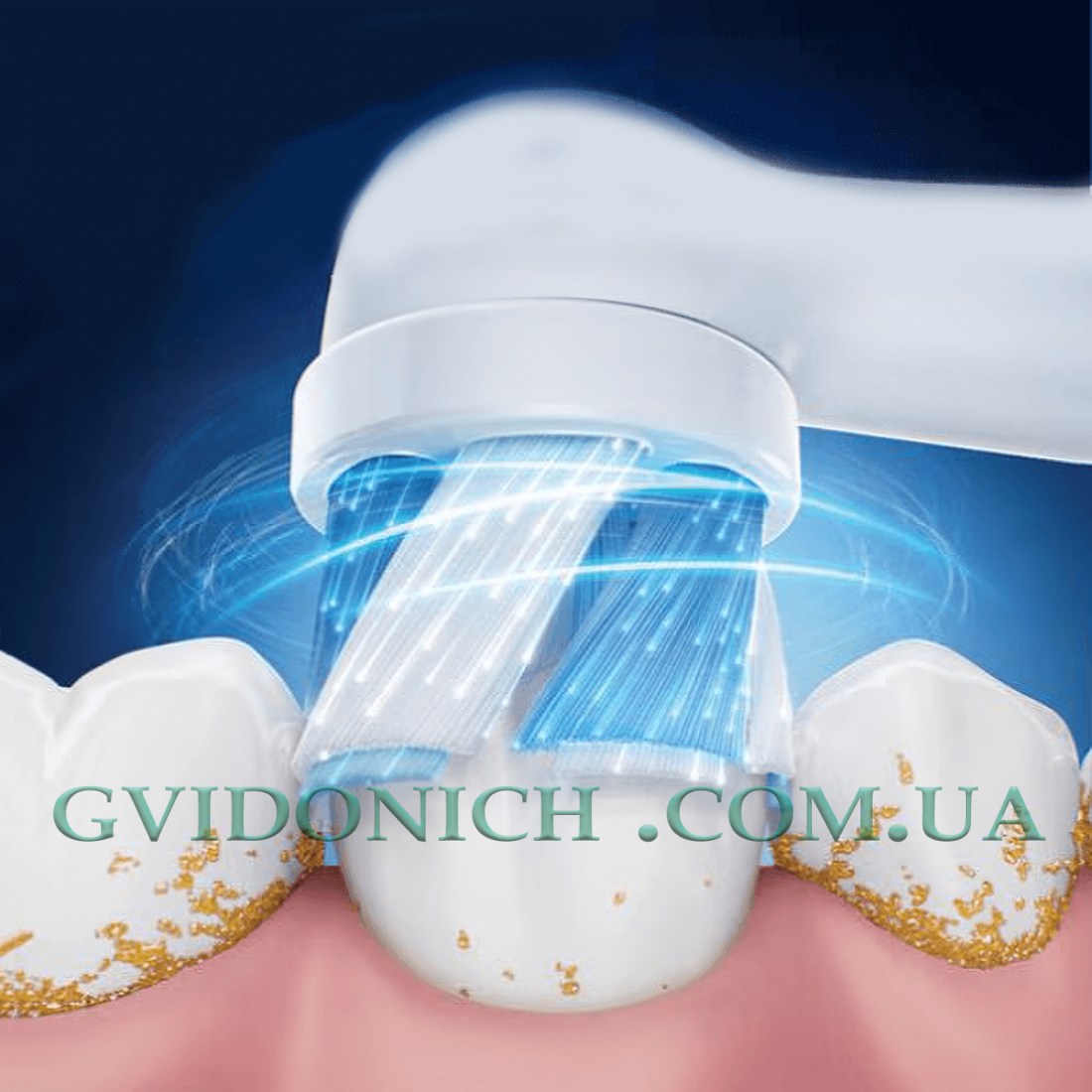 Насадки на електрощітку Oral-B iO Ultimate білого кольору 2 штуки