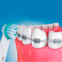 Насадки Ortodontic для ортодонтических брекетов на щетку Braun Oral B  