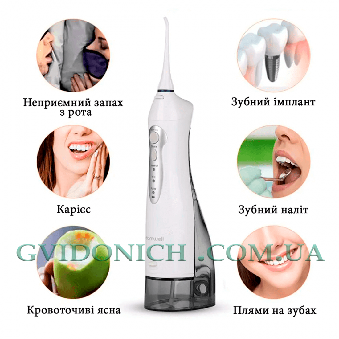 Портативный ирригатор Mornwell D52 White для гигиены ротовой полости и при ортодантическом лечении